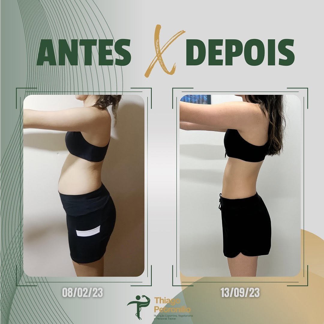 Antes e depois de paciente acompanhada por Thiago Petronilio, com evolução entre fevereiro e setembro de 2023